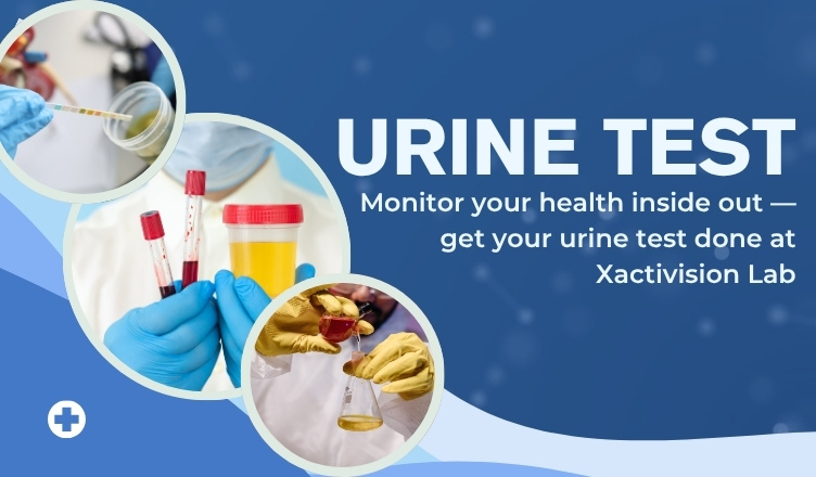 Urine Test